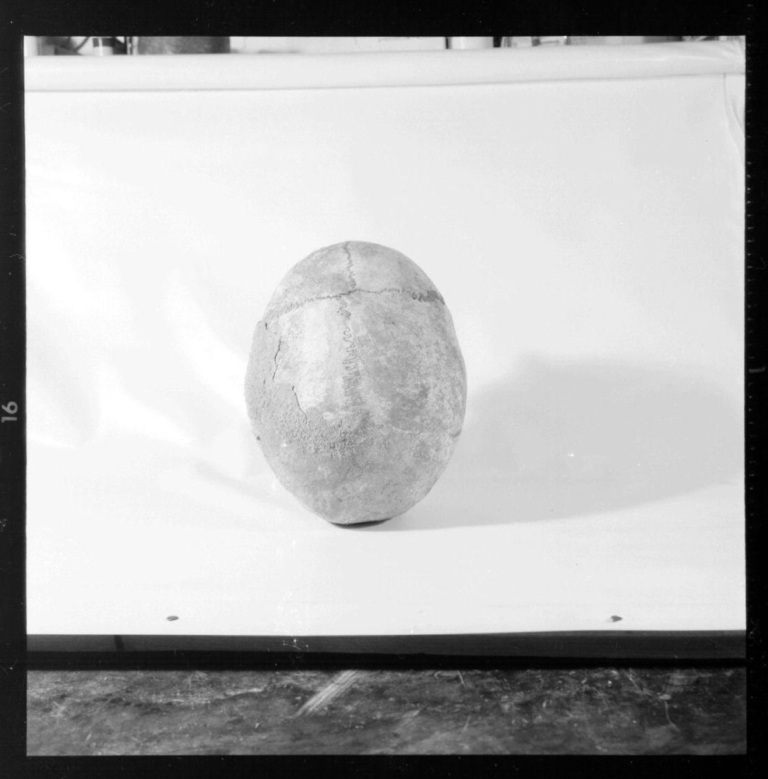Cueva de Maltravieso. Cráneo Edad Bronce. Norma occipital